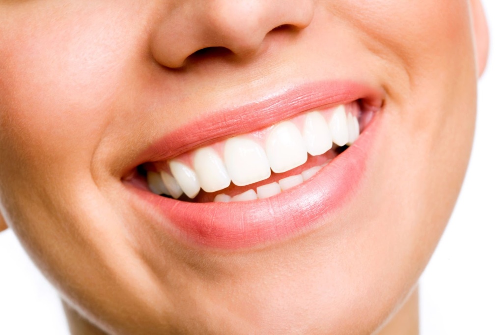 Woman Smiling After Teeth Whitening