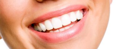 Teeth Whitening: A Complete Guide