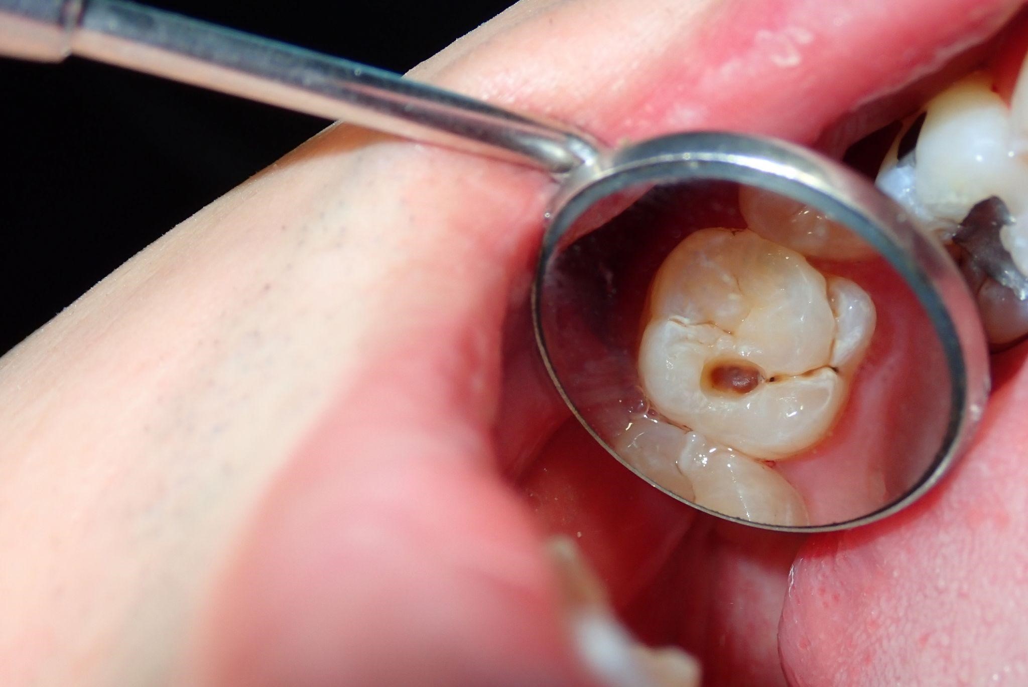 Dentist Looking In A Patient’s Mouth