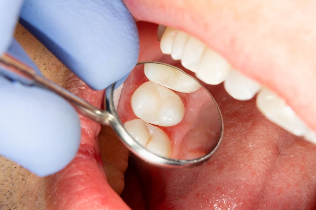 Dental Check