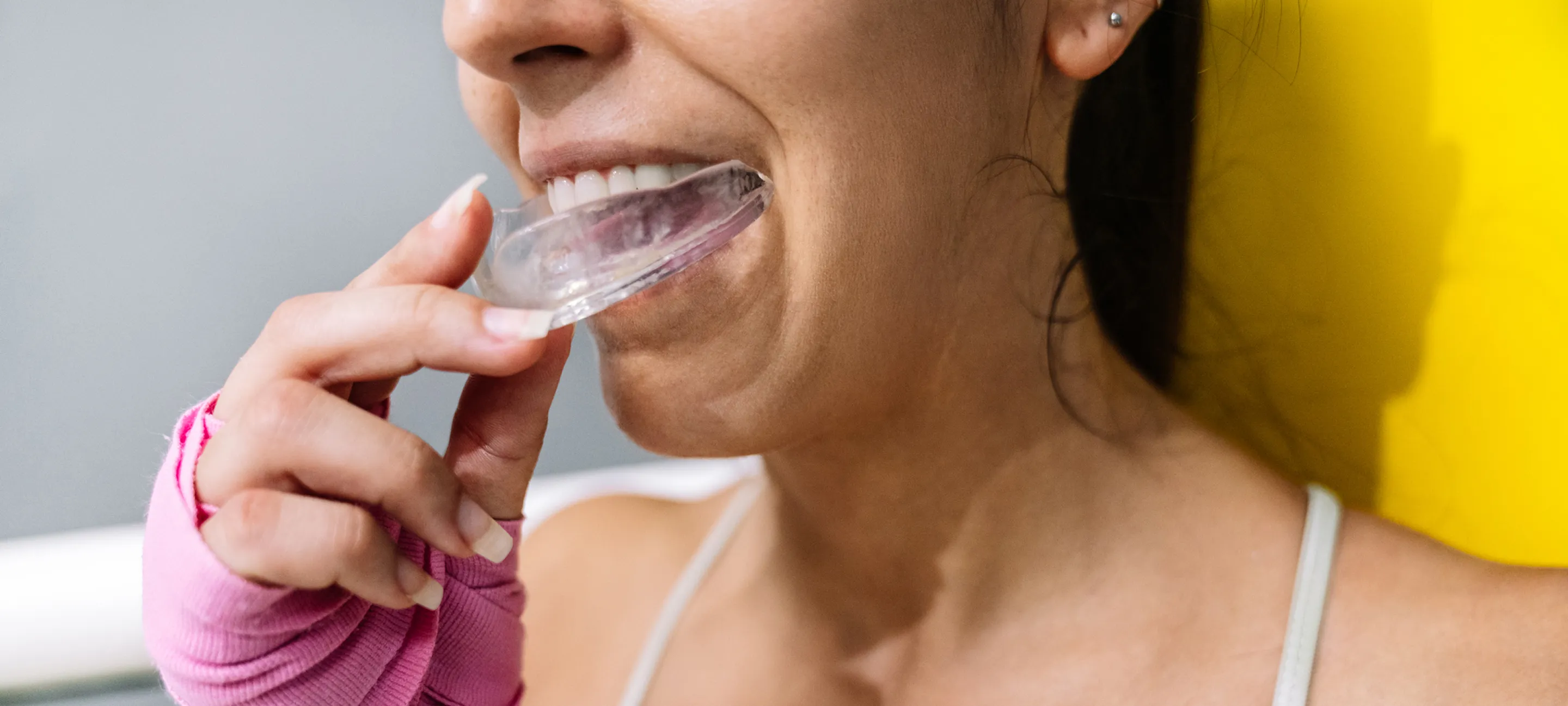 Custom Mouth Guards@2x