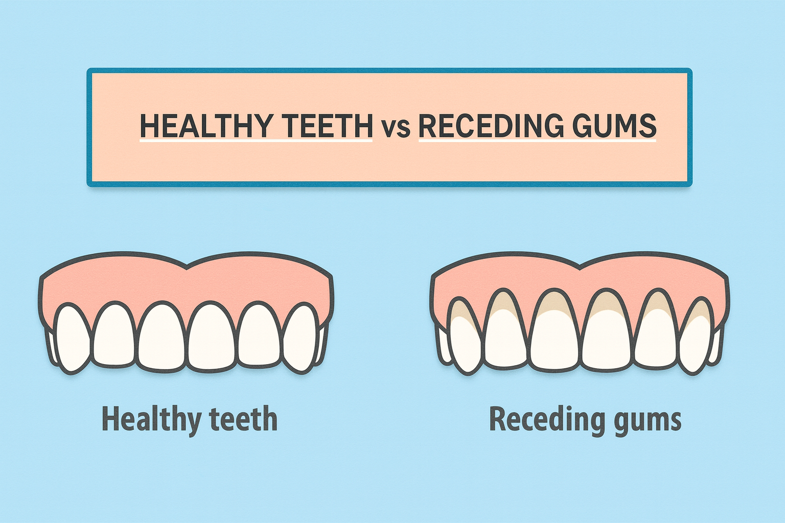 Receding Gums